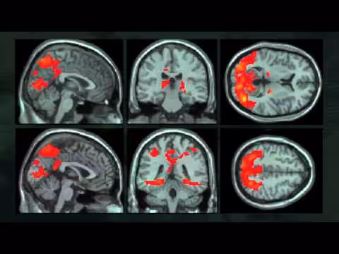 Video thumbnail for youtube video Emotion in marketing: How our brains decide what's shareable and whom to trust