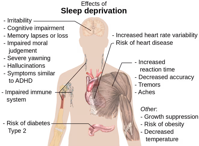 1200px-Effects_of_sleep_deprivation.svg_