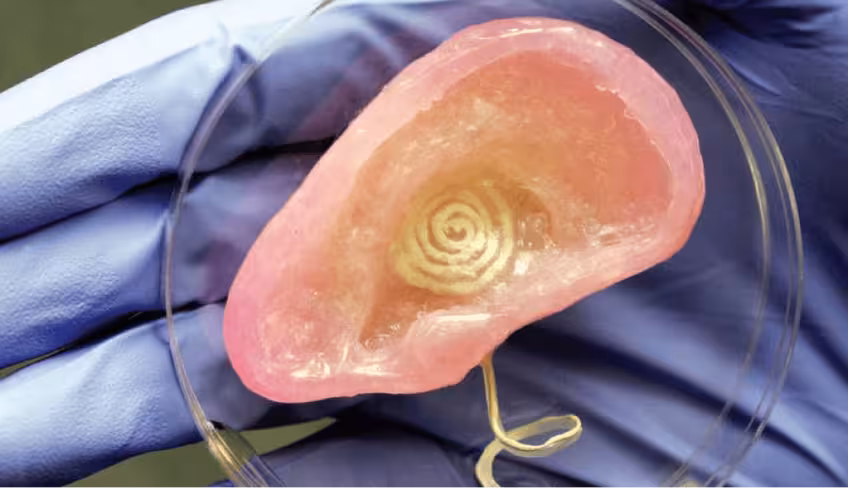 BionicEar