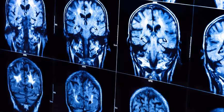 Quantum cognition theory explains why humans make stupid decisions