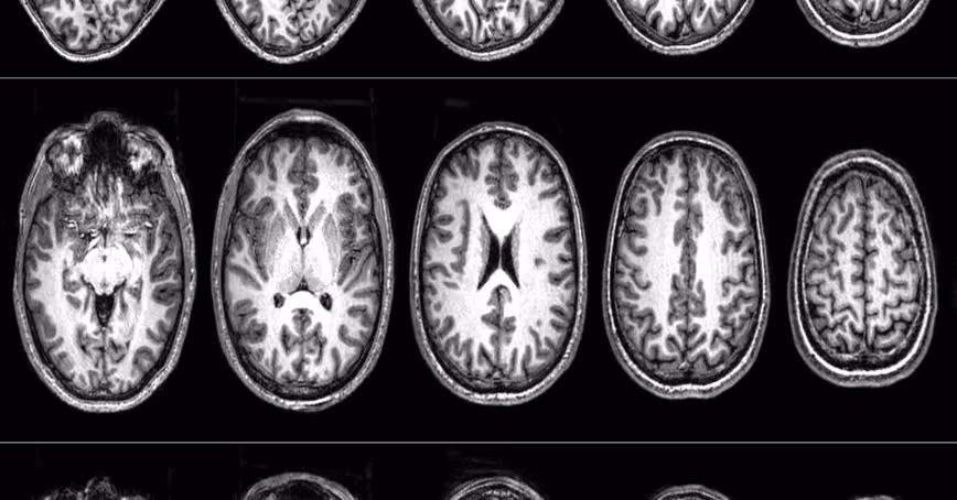 Neuroscientists scanned radicals’ brains to determine what makes them turn violent