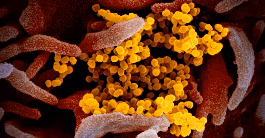 AI sent first coronavirus alert, but underestimated the danger