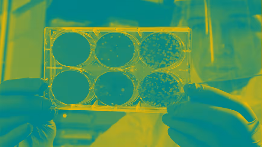 How do we improve cybersecurity? By copying our body’s immune system Featured Image