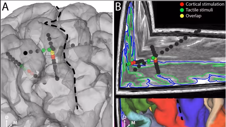 Eureka! Brain implant creates feelings in the fingertips