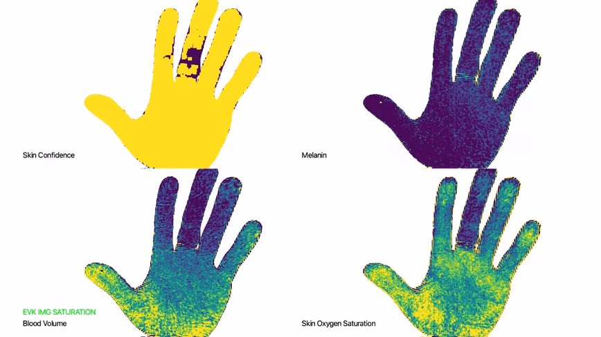 Skin_biomarker_demo