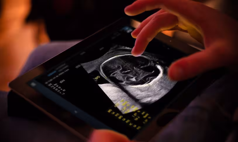 Samsung completes €86M takeover of French AI ultrasound startup Sonio