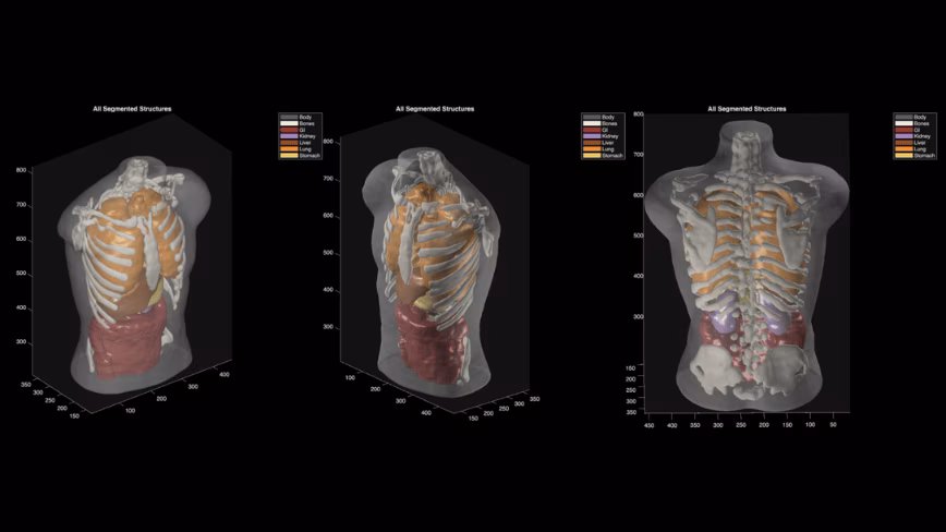 Midjourney says its new full-body scanner beats an MRI. It has never built hardware before.