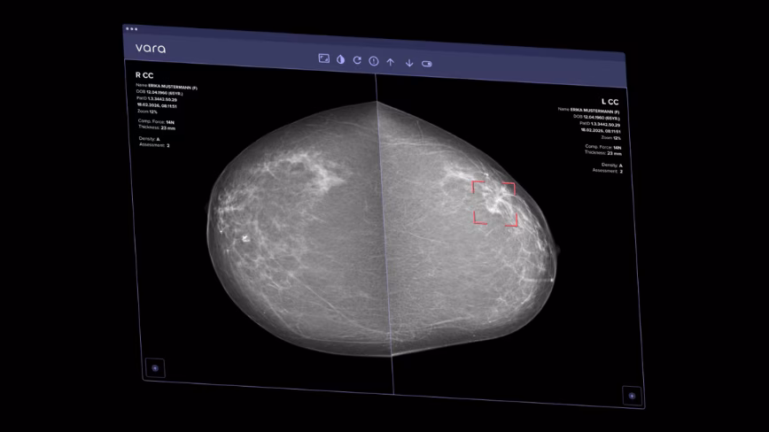 Vara wins world’s first CE mark for AI that clears mammograms alone
