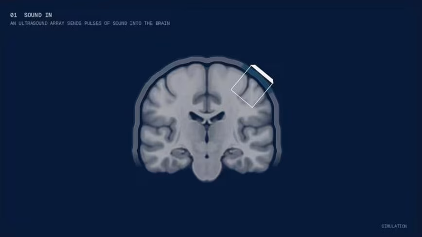 Bridge Neurotech привлекает 13,5 млн долларов, чтобы считывать сигналы мозга с помощью ультразвука — без импланта