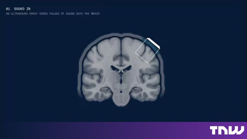 https://media.thenextweb.com/2026/10/brain-coronal-section-ultrasound-array-simulation-navy.jpg