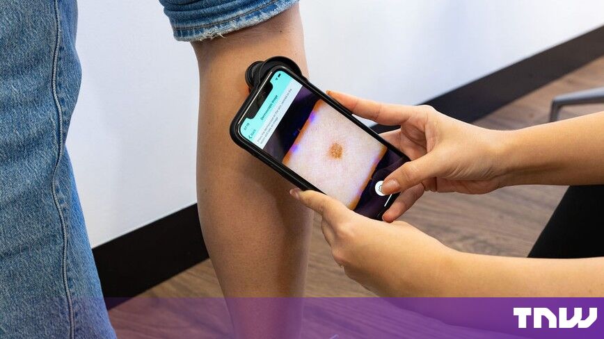 https://media.thenextweb.com/2026/10/derm-smartphone-dermoscope-lesion-image-leg.jpg